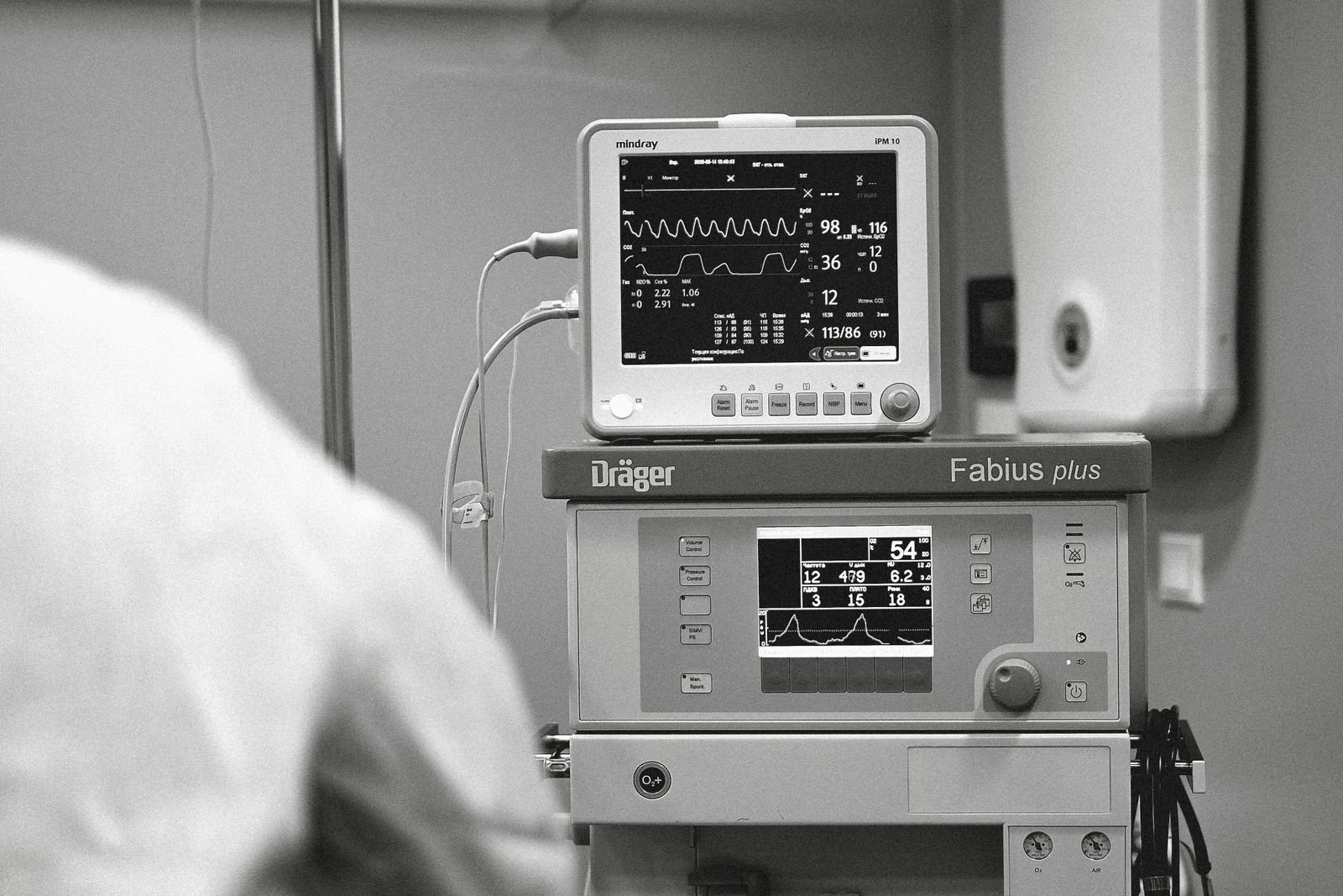 Maquina de anestesia en una sala de hospital