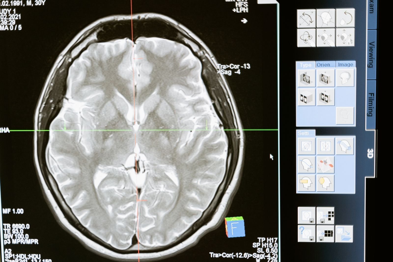 Imagenes de resonancia cerebral en una estacion de diagnostico